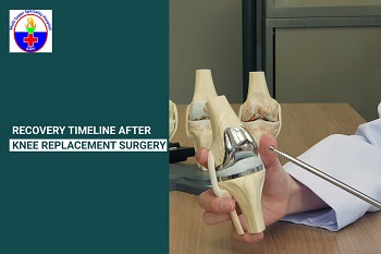 Recovery Timeline After Knee Replacement Surgery: Step-by-Step Guide ...